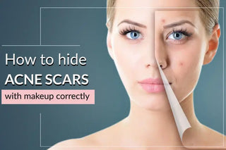 How to hide acne scars with makeup correctly?